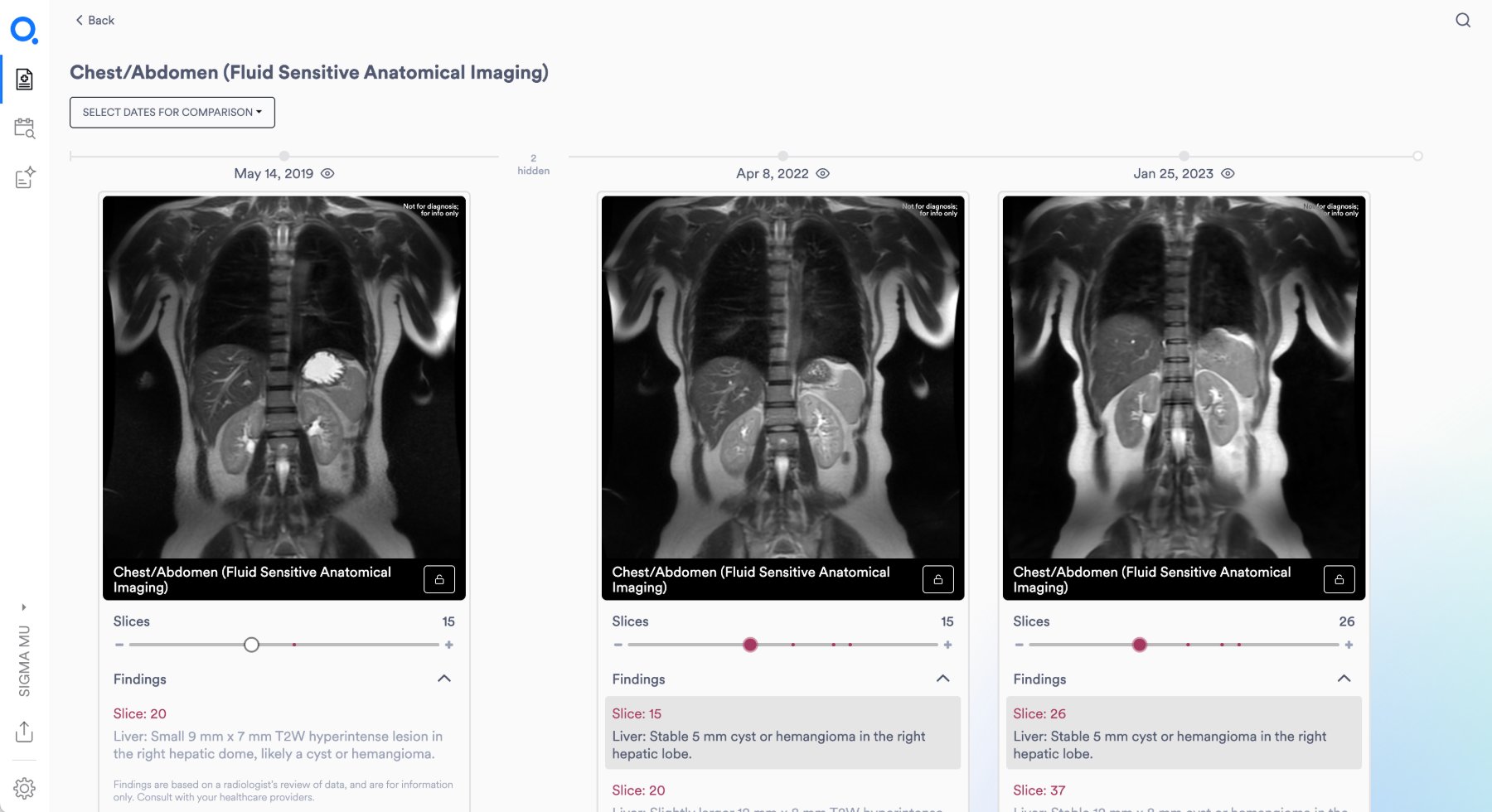 Three side-by-side chest and abdomen MRI images dated May 2019, April 2022, and January 2023, each with slice controls and radiologist findings listed beneath.
